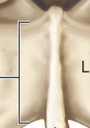 <p>Label</p>