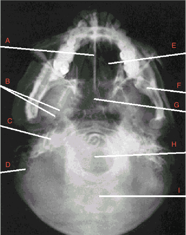 <p>what is B pointing to? </p>