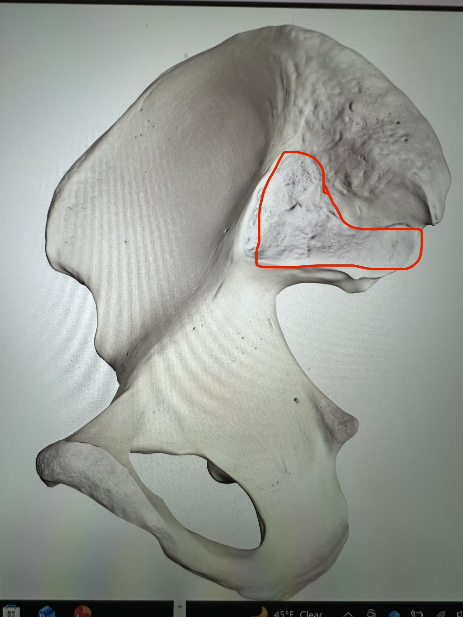 <p>os coxae, ear shaped surface next to iliac fossa</p>