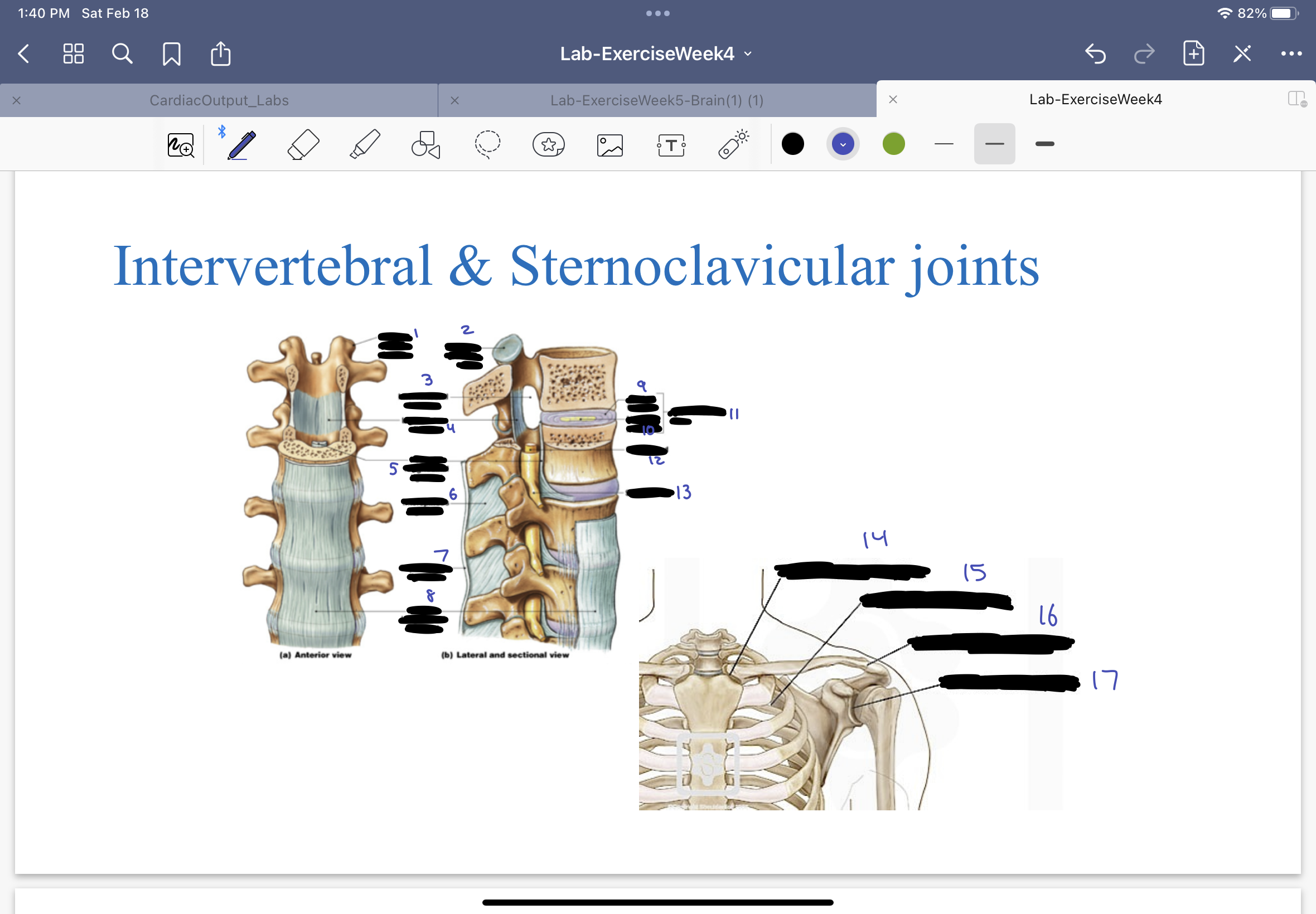 <ol><li><p>superior articular process</p></li><li><p>superior articular facet</p></li><li><p>intervertebral foramen</p></li><li><p>ligamentum flavum</p></li><li><p>posterior longitudinal ligament</p></li><li><p>interspinous ligament</p></li><li><p>supraspinous ligament</p></li><li><p>anterior longitudinal ligament</p></li><li><p>anulus fibrosus</p></li><li><p>nucleus pulposus</p></li><li><p>intervertebral disc</p></li><li><p>spinal cord</p></li><li><p>spinal nerve</p></li><li><p>sternoclavicular joint</p></li><li><p>scapulothoracic joint</p></li><li><p>acromioclavicular joint</p></li><li><p>glenohumeral joint</p></li></ol>