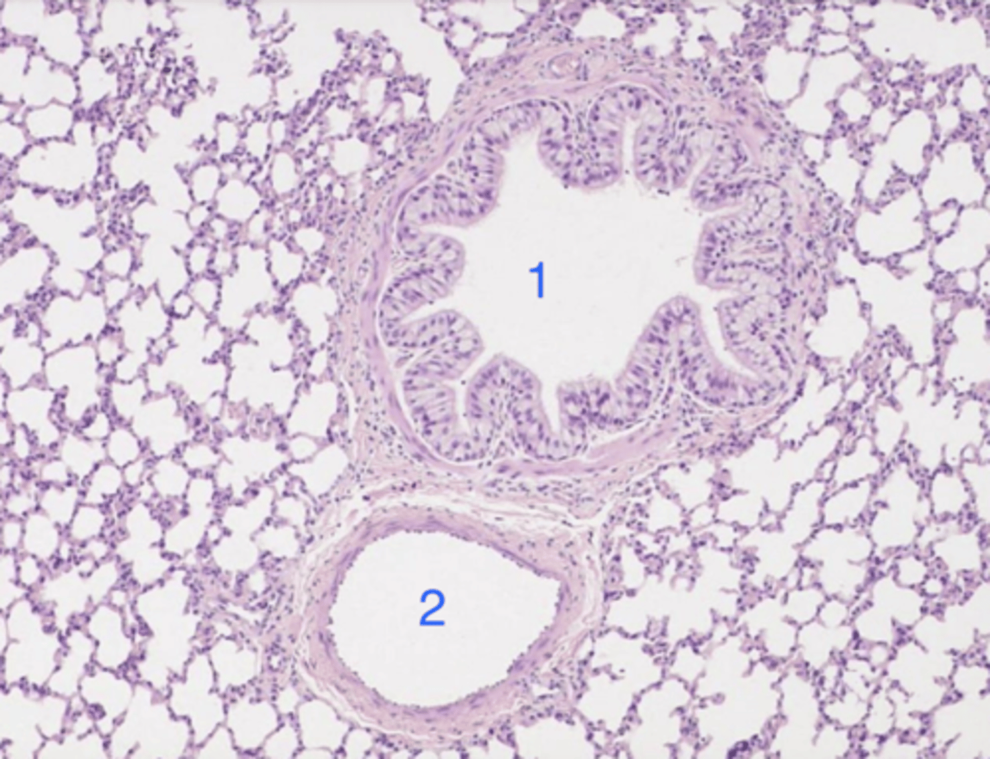 <p>what is 1? why?</p>