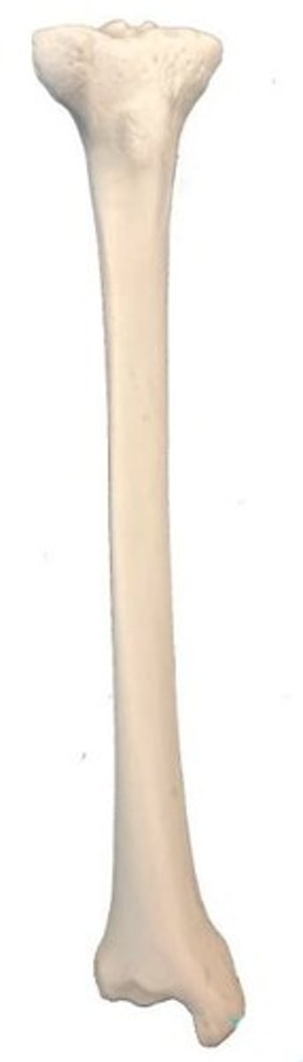 <p>Identify this bone.</p>