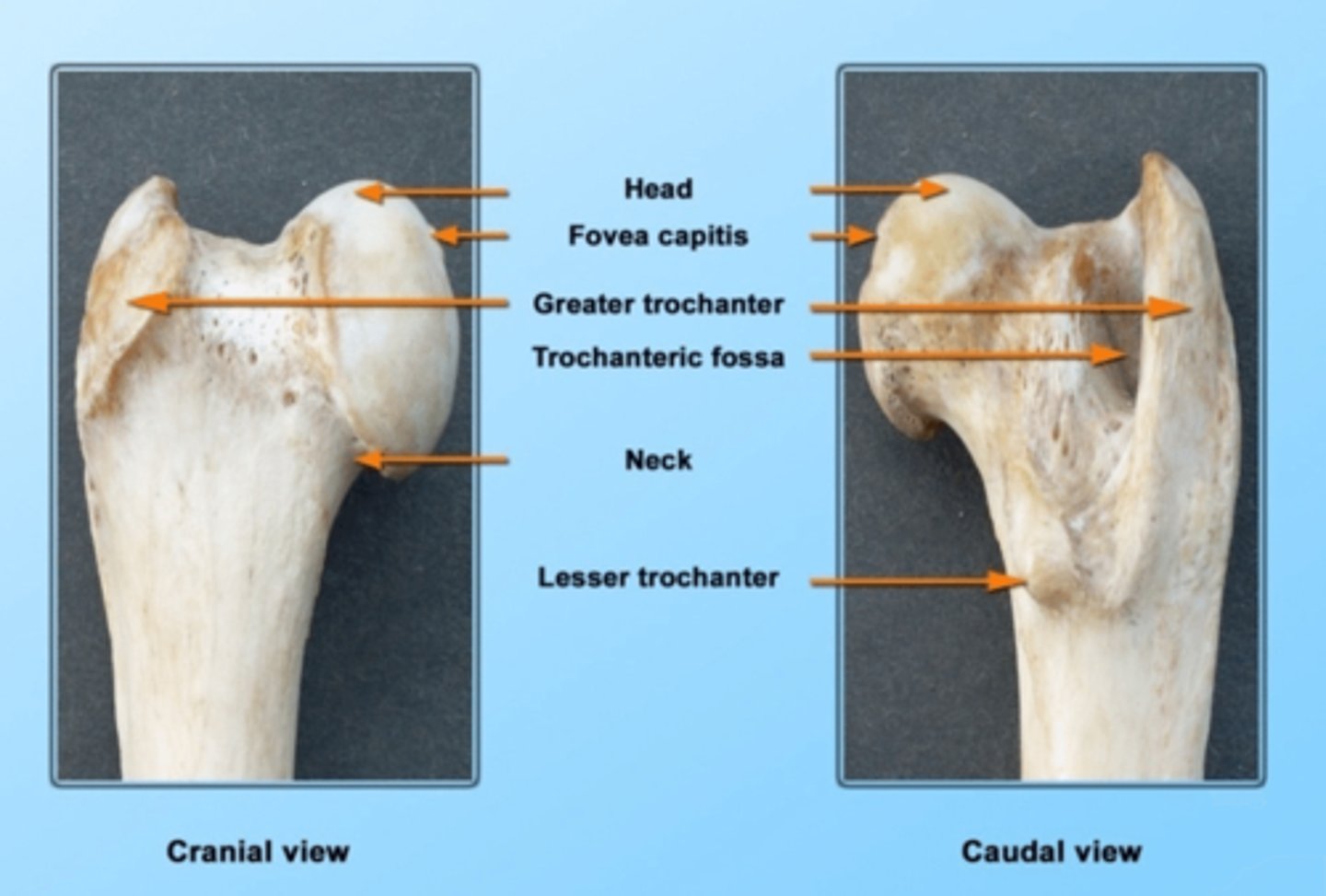 <p>where the ligament of the head of the femur attaches</p>
