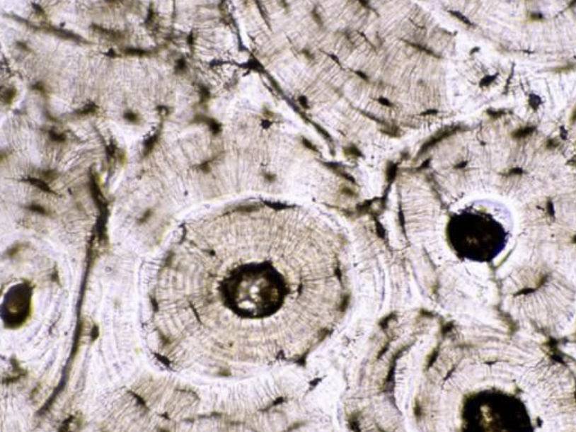 <p>-cells enclosed in <strong>calcium salts</strong></p><p><strong>-function</strong> → <strong>protection of soft organs </strong>& <strong>support</strong></p><p>located in <strong>skeleton </strong></p>