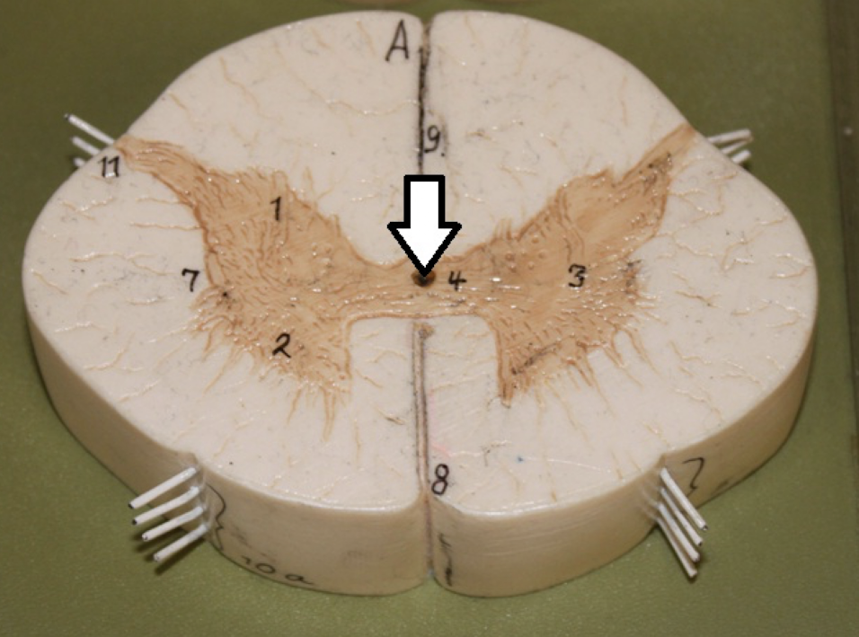 <p>identify this structure/opening</p>