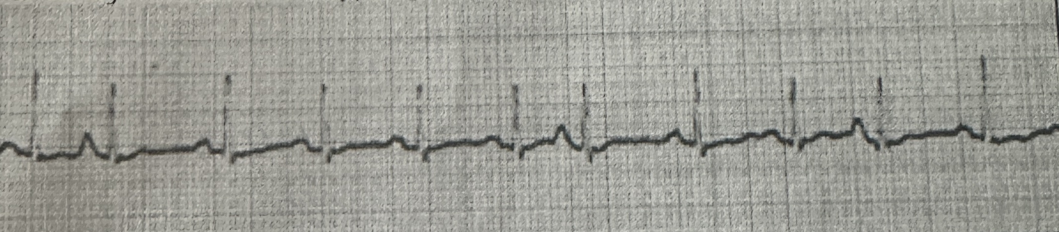 <p>identify this rhythm strip</p>