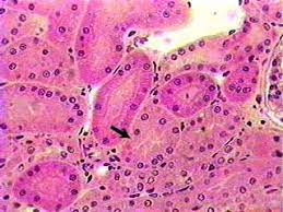 <p>a type of tissue found in the body. It consists of a single layer of cube-shaped cells. This type of epithelium is commonly found in areas where secretion and absorption occur, such as the kidney tubules and the ducts of certain glands. It provides protection and helps in the exchange of substances between the cells and their environment.</p>