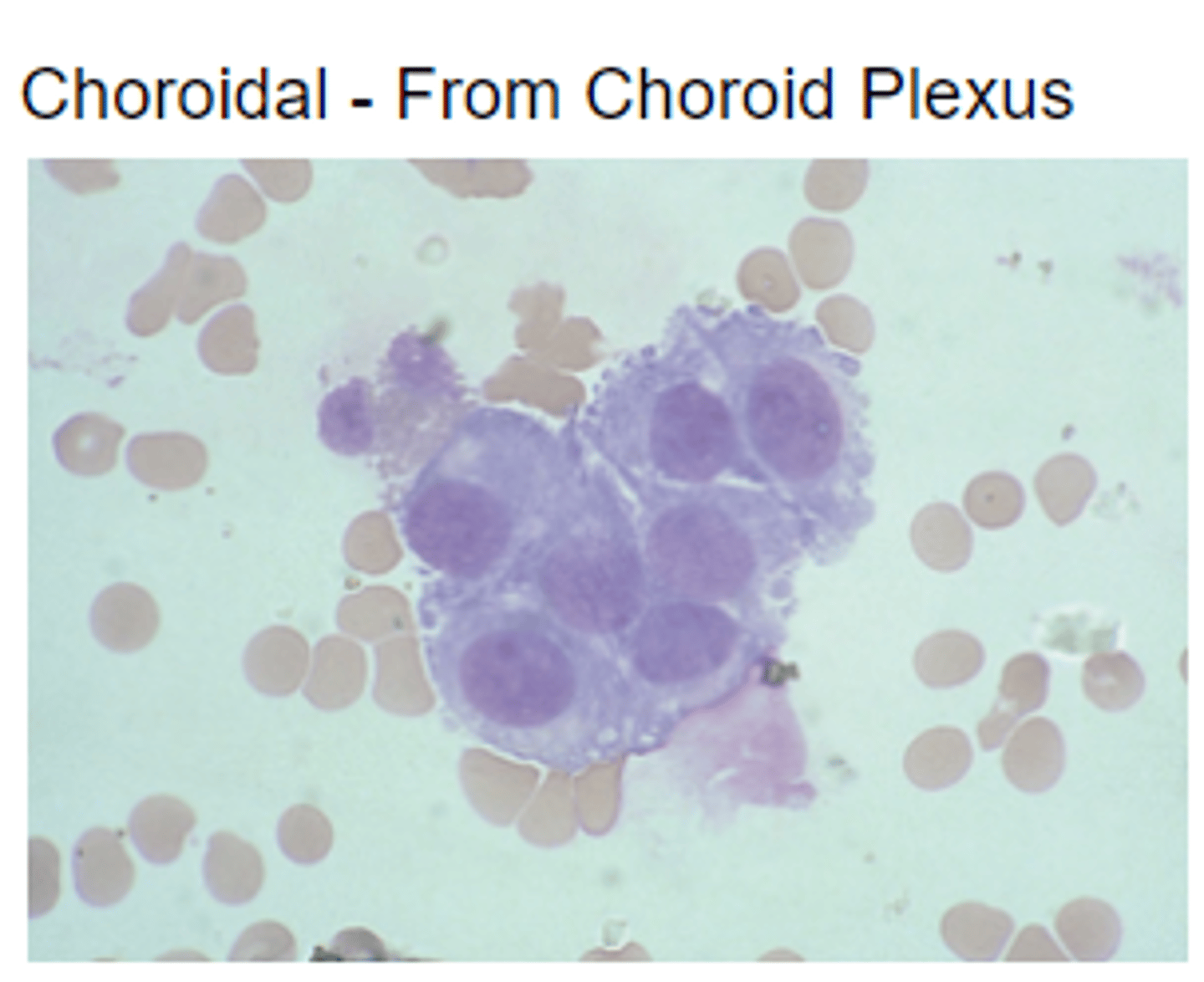 <p>Cells that line the choroid plexus</p>