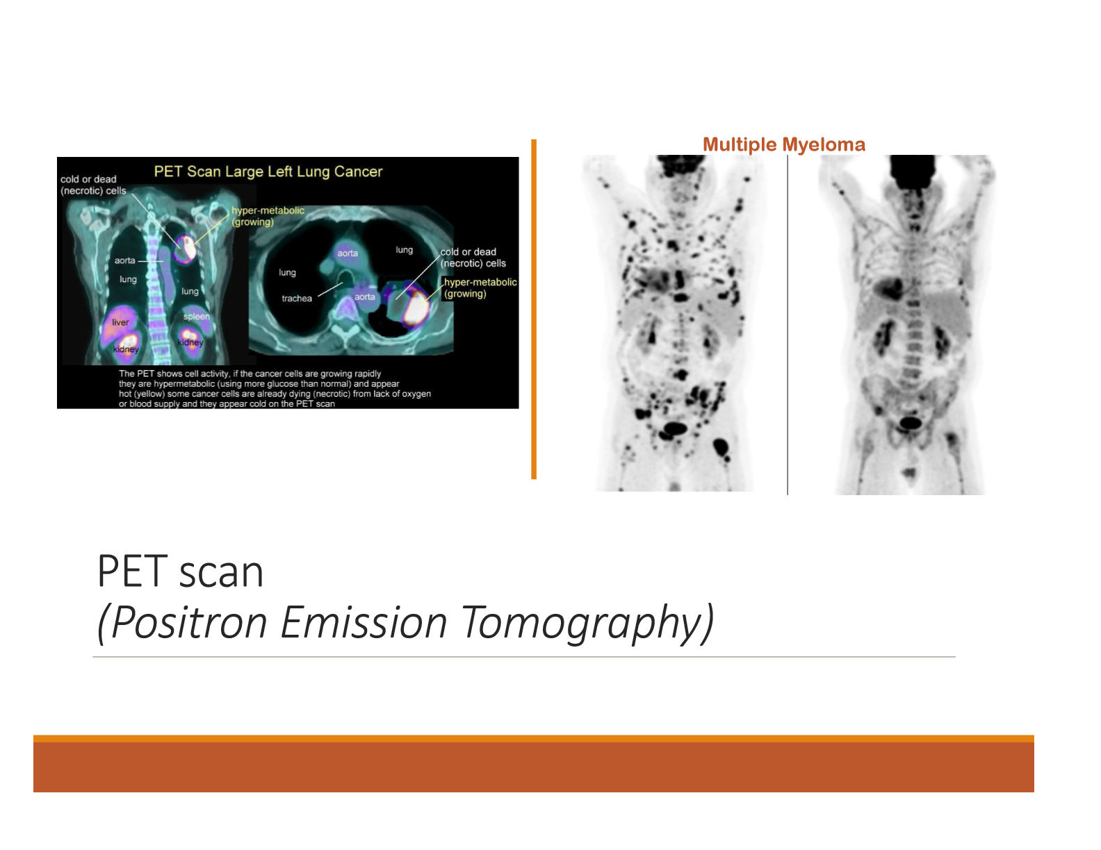 <p>Imaging test that uses a small amount of radioactive material (radiotracer) to visualize how tissues and organs are functioning. </p>