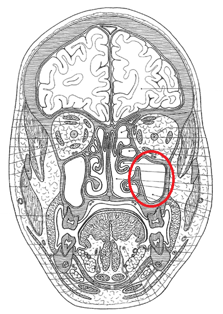 term image