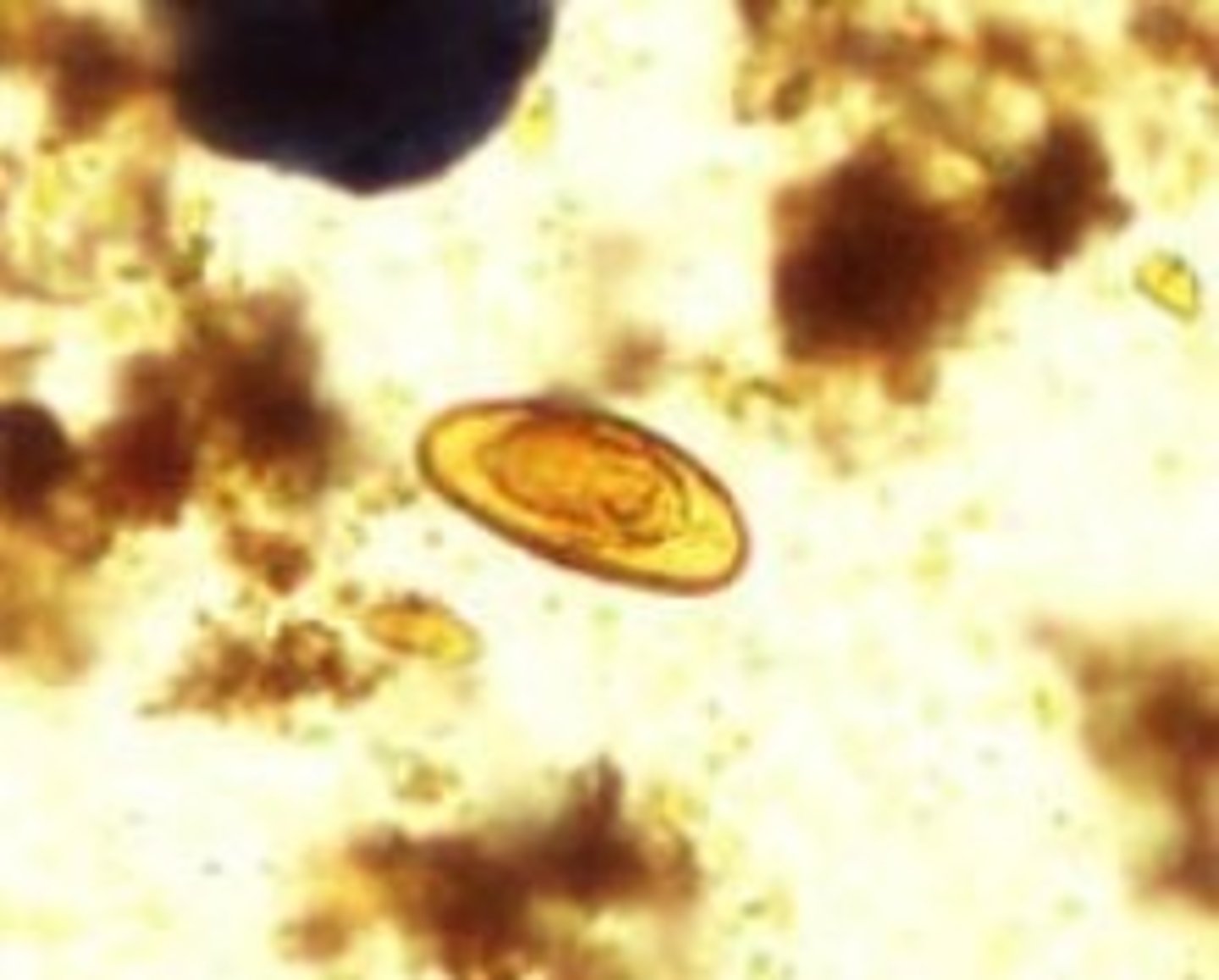 <p>Identify the parasite</p>