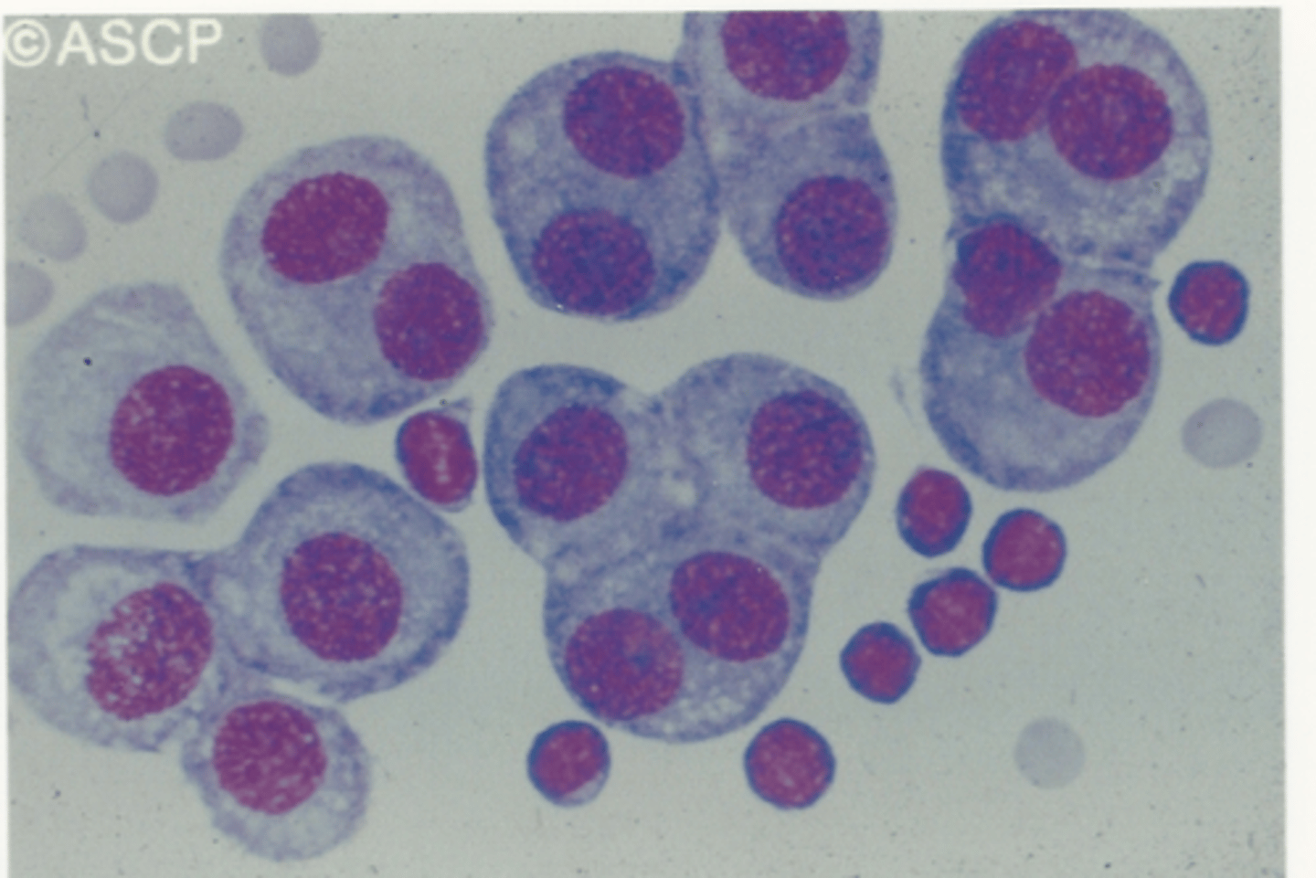 <p>Identify the cells in this body fluid</p>