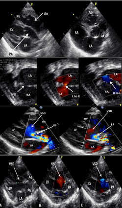 <p>What are these images of?</p>