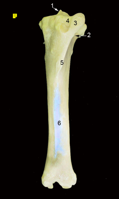 <p><strong>3</strong> -<strong> </strong>(cara cranial) (eq.)</p>