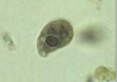 Trofozoíto de Entamoeba histolytica