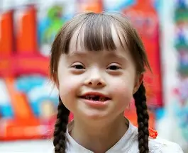 <ul><li><p><span style="color: rgb(245, 64, 64);"><strong>Down Syndrome</strong></span></p></li><li><p>xtra 21 chromosome → disability and physical features</p><ul><li><p>flat nose</p></li><li><p>wide eyes</p></li><li><p>short neck</p></li><li><p>smaller ears</p></li><li><p>protruding tongue</p></li></ul></li></ul><p></p>