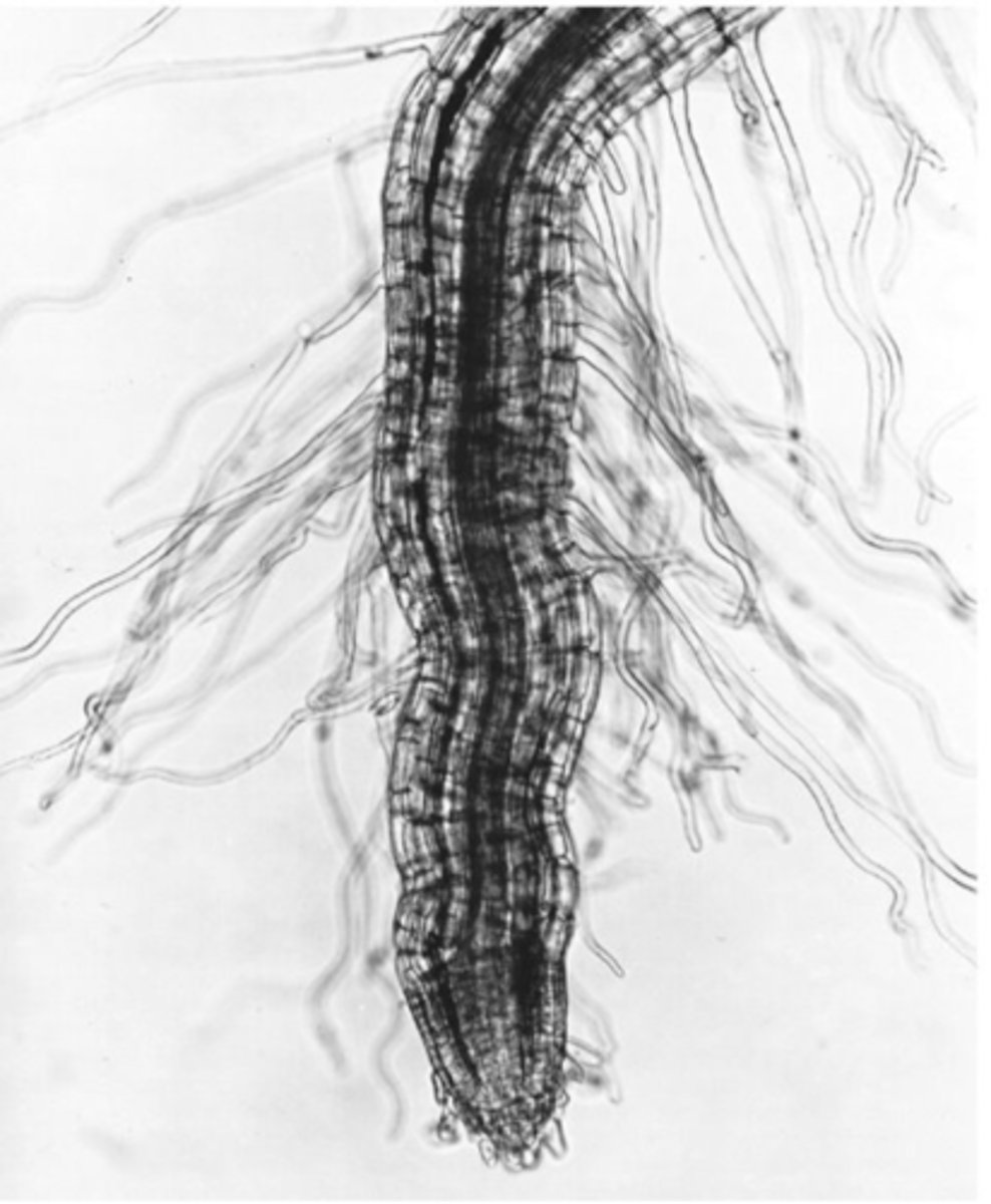 <p>What structures are being pictured here on this root?</p>