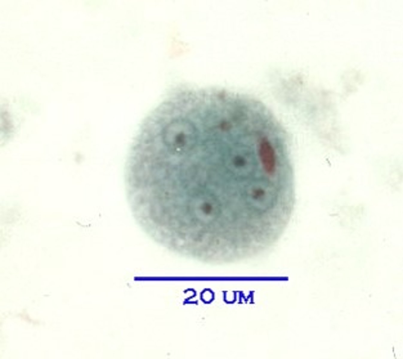 <p>up to 8 nuclei, splintered chromatid bodies</p>
