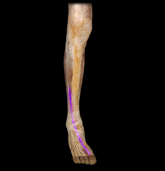 <p>IDENTIFY THIS MUSCLE</p>