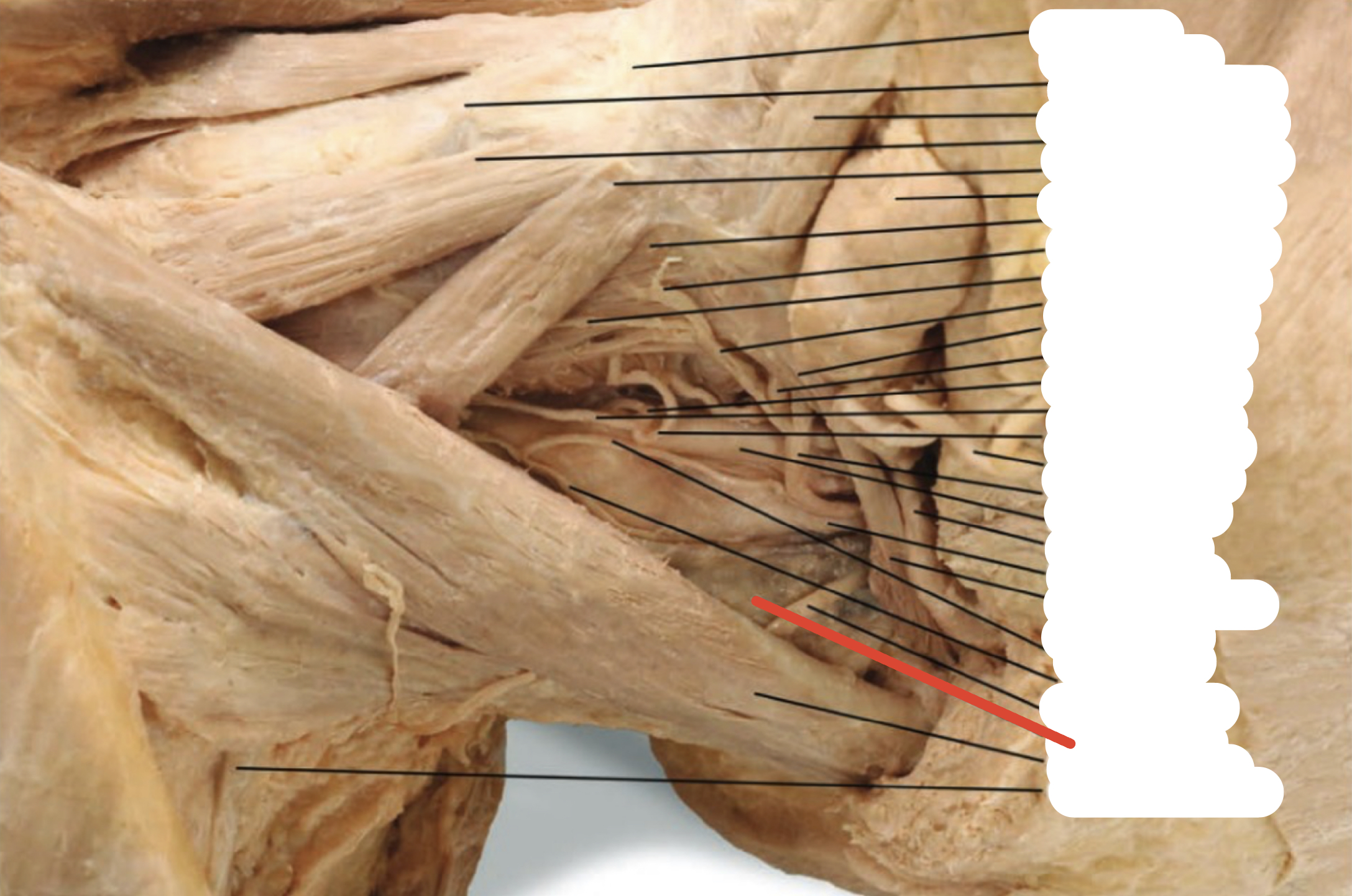 Identify the structure (red line)