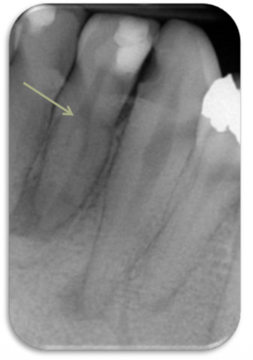 <p>ID the problem:</p>