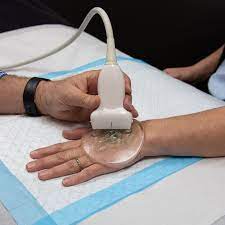 <p>A layer of gel-like material used to improve imaging of superficial layers.</p>