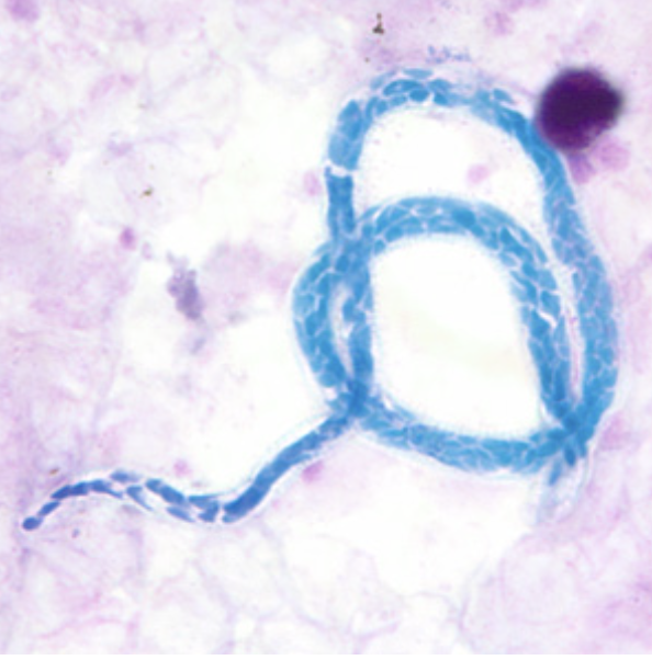 <p>small, no sheath, blunt tail with nuclei extending to end of tailL</p>
