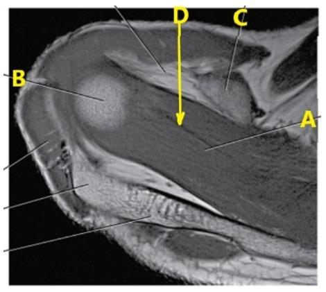 <p>What is letter D arrow pointing to?</p>