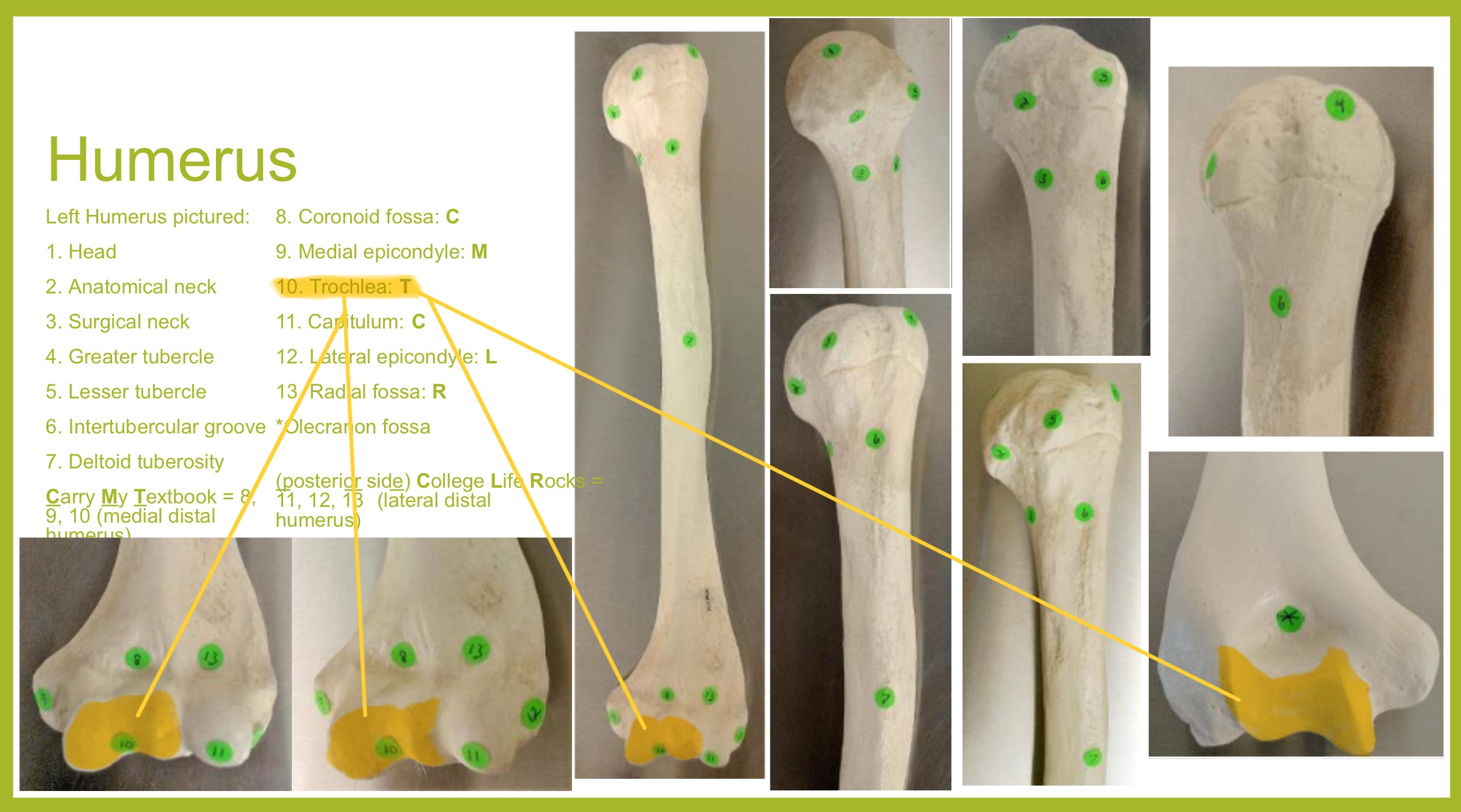 <p>trochlea (condyle) of humerus</p>