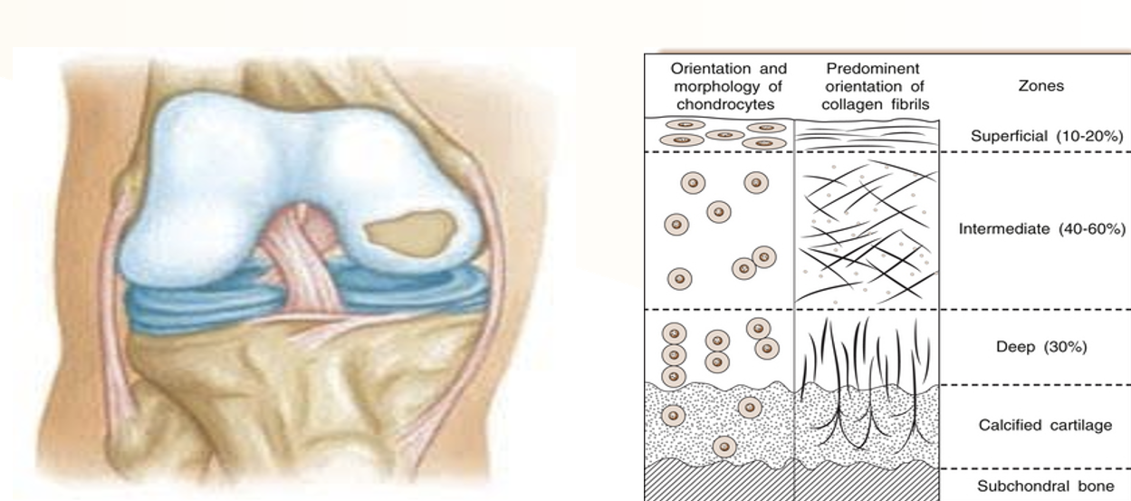 <p>The outermost layer of articular cartilage, where chondrocytes are flattened and compact</p>