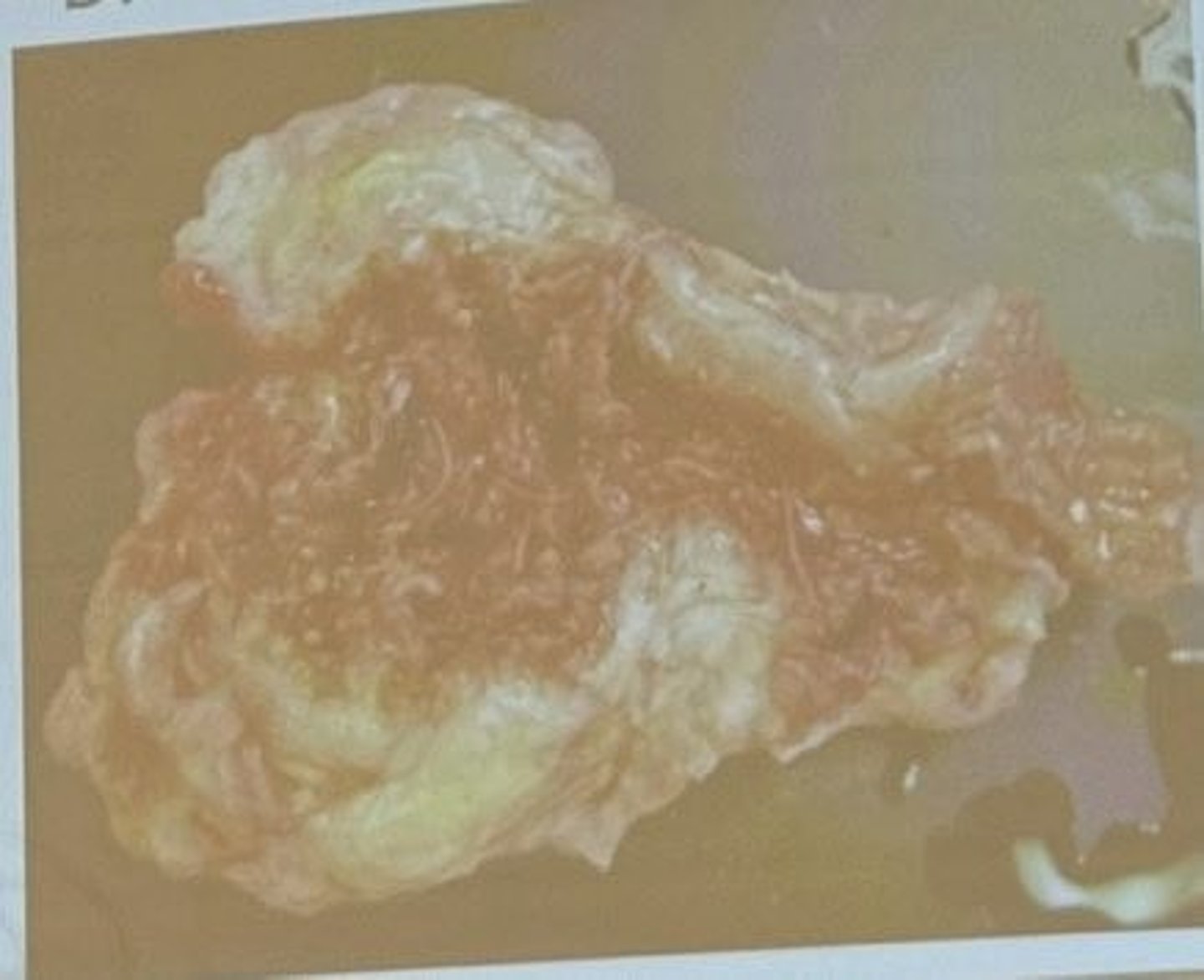 <p>Strongylus vulgaris</p><p>3 multiple choice options</p>