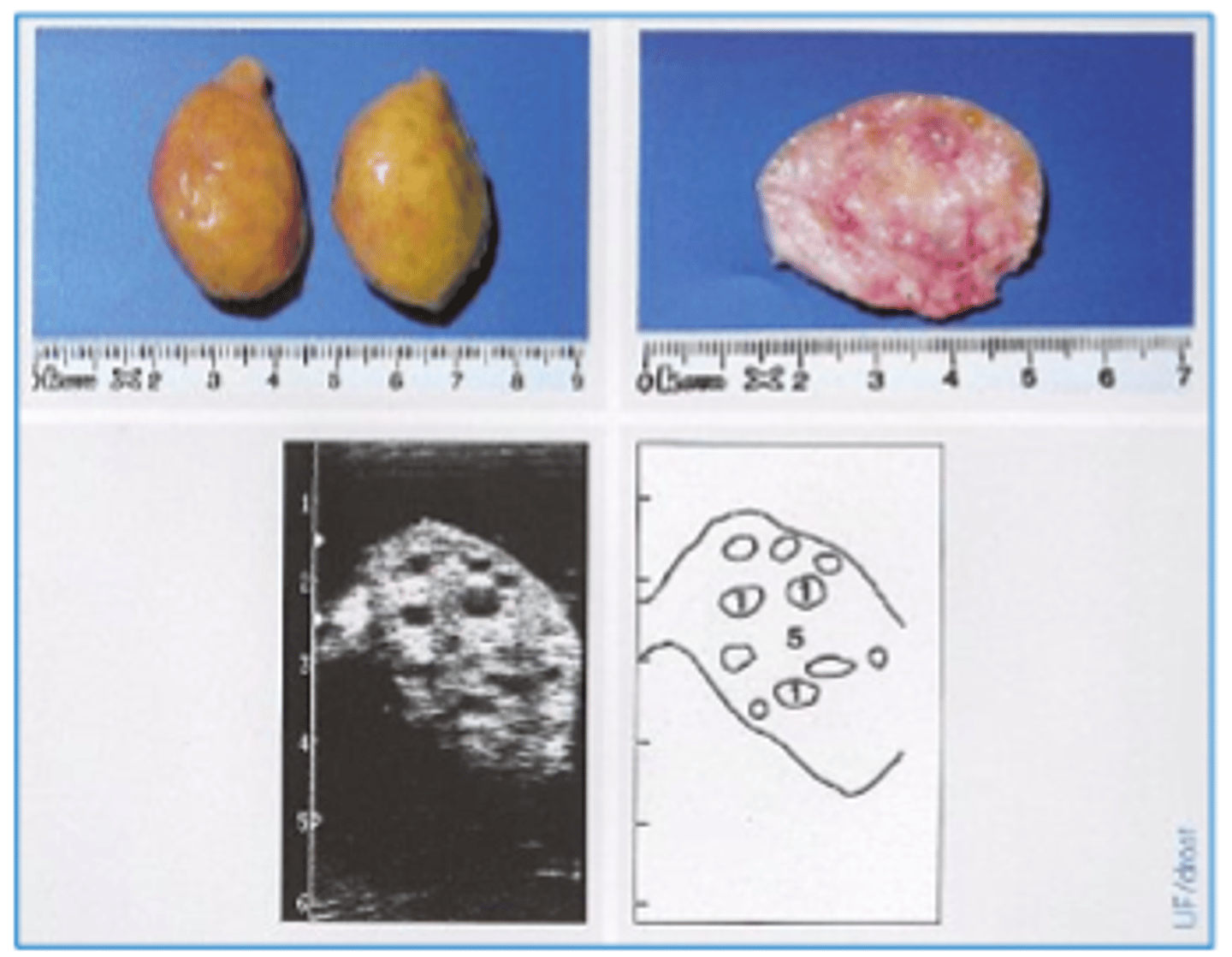 <p>- Small ovaries</p><p>- Small sized follicles</p><p>- Absent CL</p><p>- Anovulatory = anoesturs accompanied by failure to ovulate</p><p>- Ovulatory = anoesturs accompanied by ovulation</p>