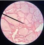 <p>What type of epithelium is this?</p>