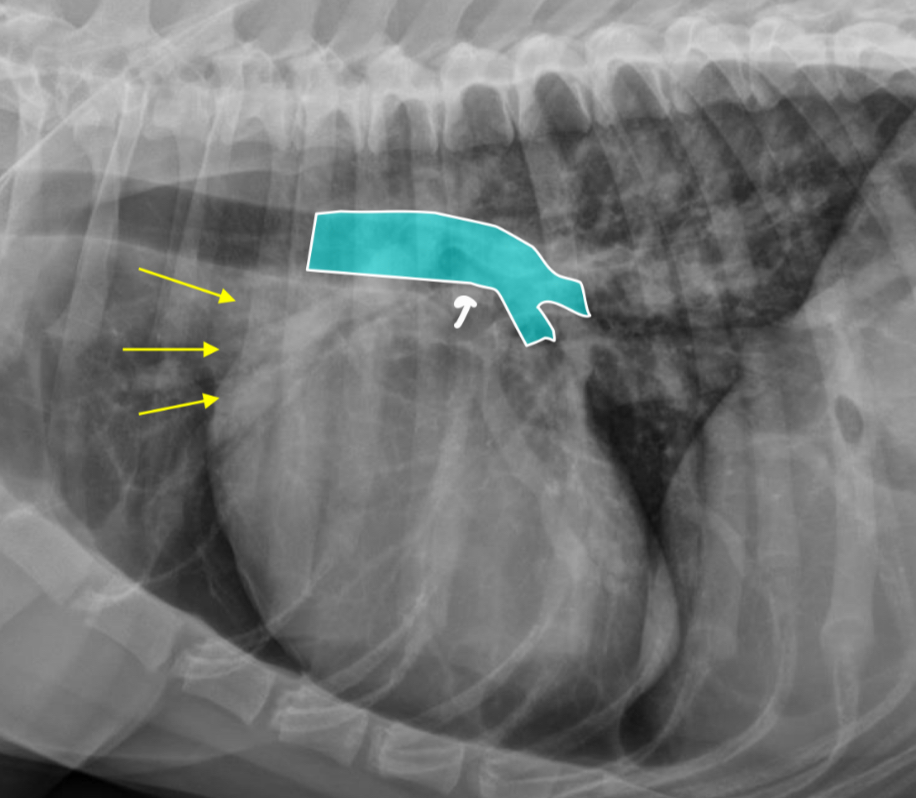 <p>-dorsal bowing of trachea over cranial heart base @ bifurcation</p><p>-loss of cr.cardiac waist (R.atrium and MPA are here)</p>