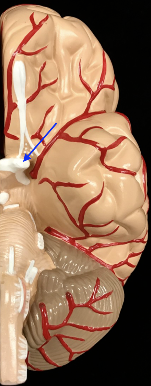 <p>What is the cranial nerve and roman numeral?</p>