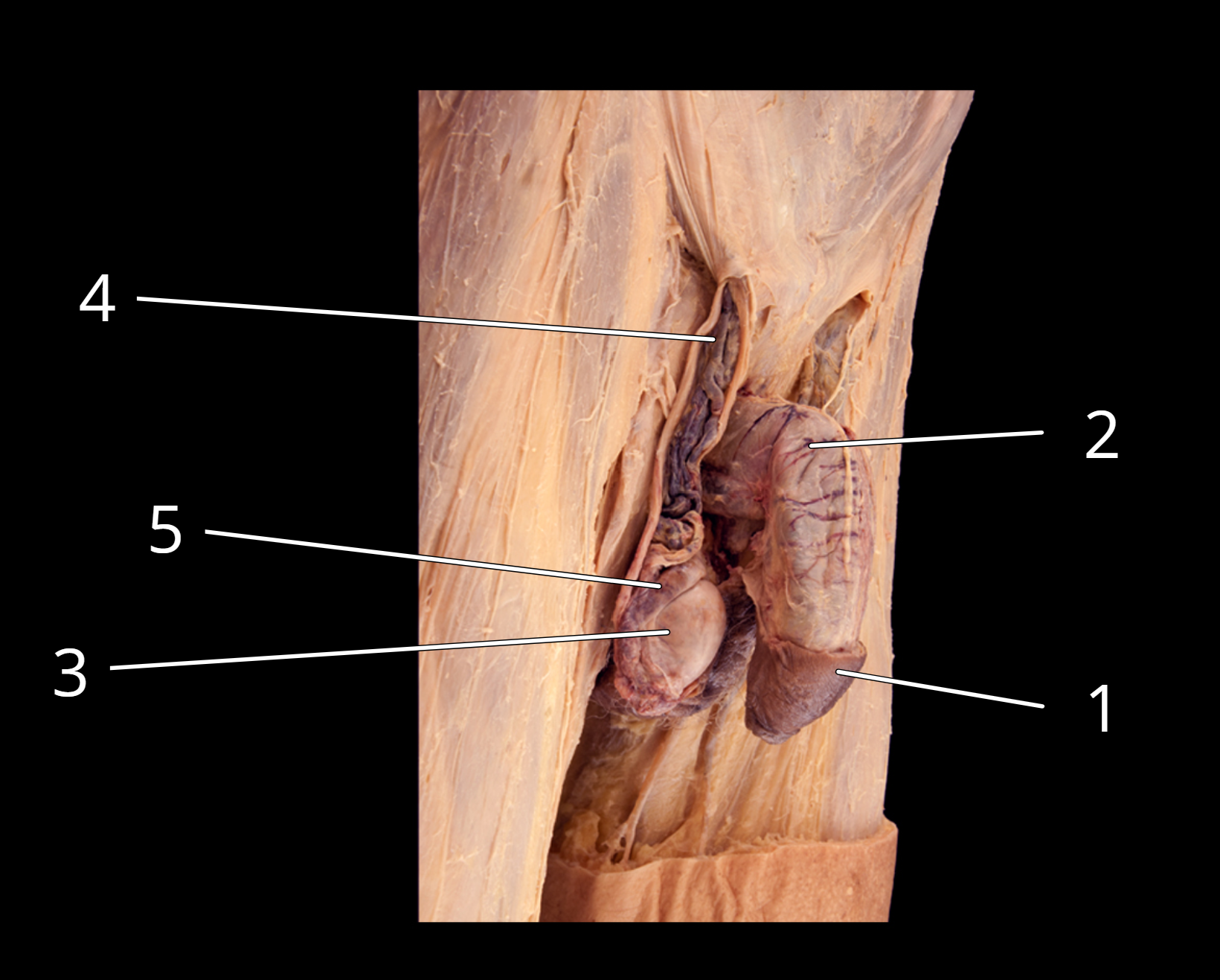 <p>Penis and testis, lateral view</p>