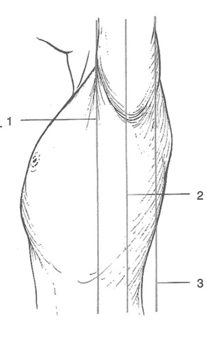 <p>imaginary vertical line from the middle of the armpit to the angle</p><p>Divides the body into anterior and posterior</p>