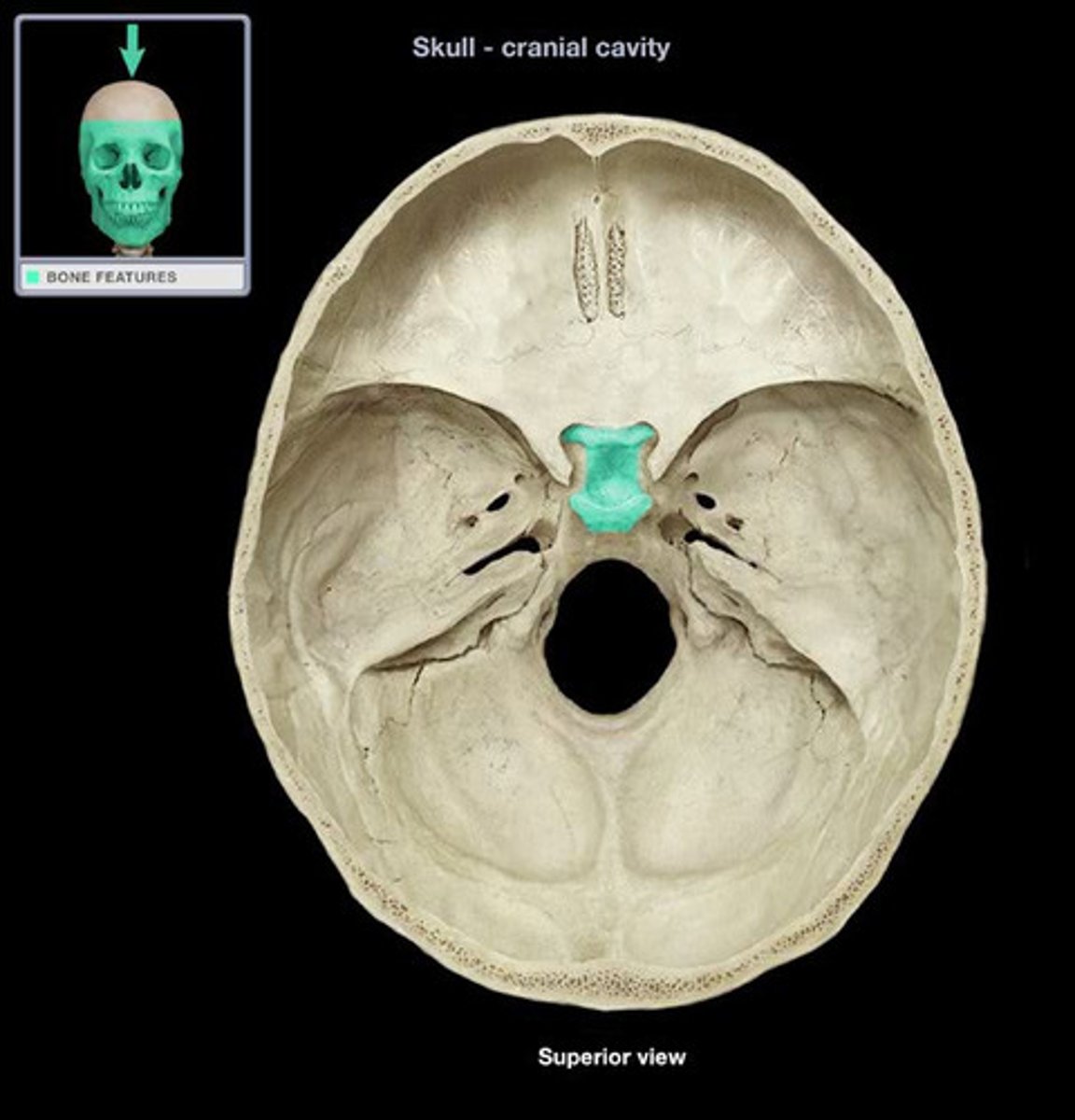 <p>depression in the sphenoid bone where the pituitary gland is located</p>