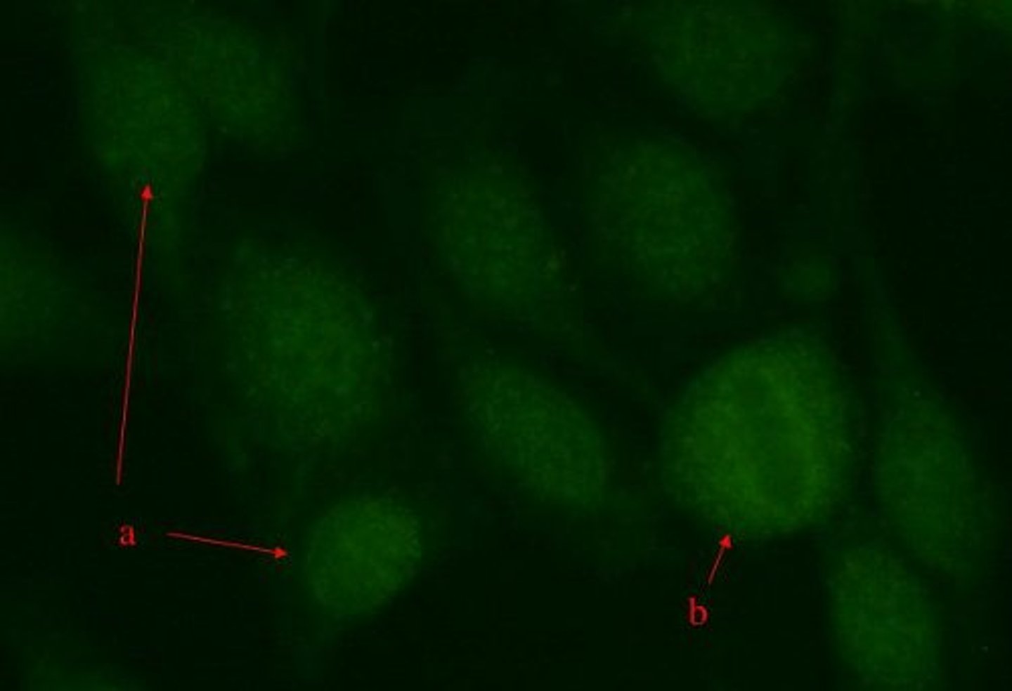 <p>Which antinuclear antibody (ANA) pattern is seen in the image on the right, which represents the result of an ANA test viewed using fluorescent microscopy?</p>