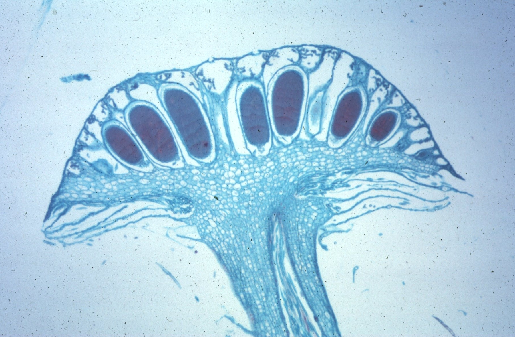 <p>Is this antheridia (male) moss or liverwort</p>