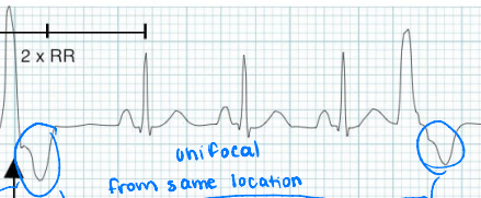 <p>Are these unifocal or multifocal?</p>
