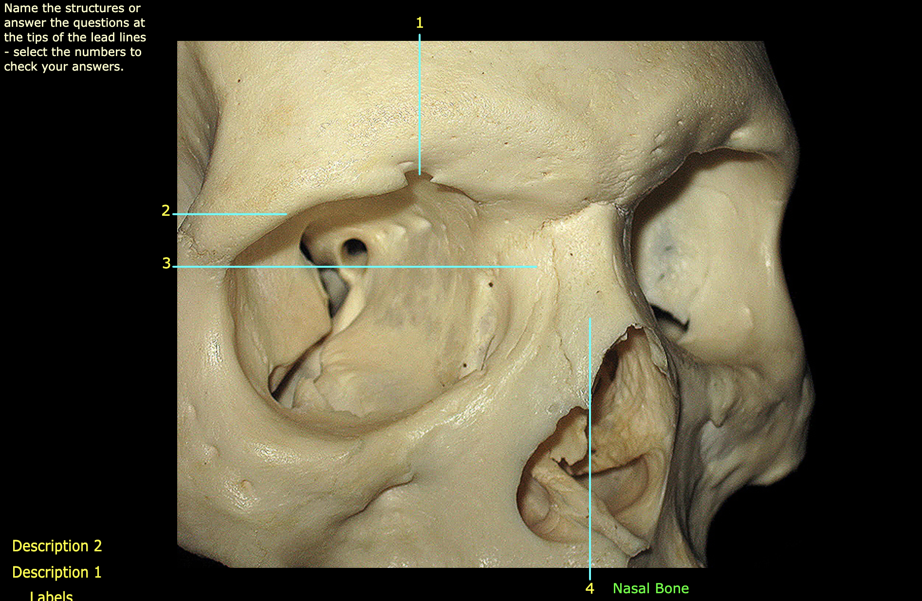 what structure is labeled 4?