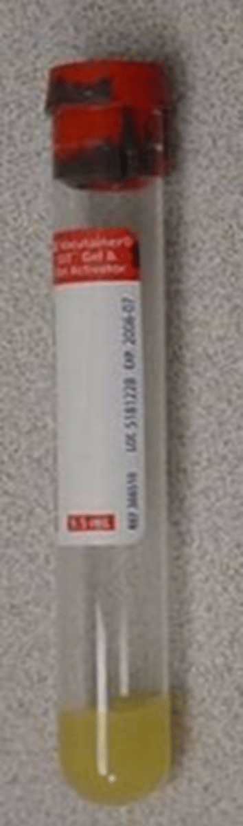 <p>a clot activator, gel is for serum sepatartion</p>