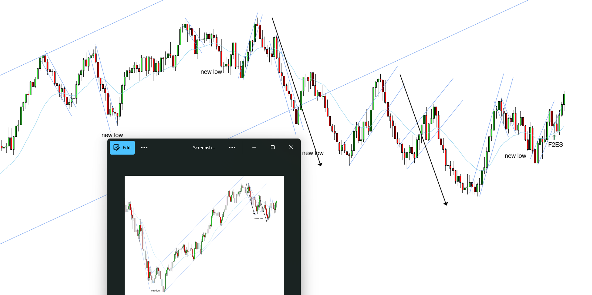 <p>L - Three uptrends need a new high, the main uptrend and the two secondary uptrends - downtrend played out with a break and new low - prices pushed above the EMA and a new high is expected for all the uptrends - F2ES formed which is what is expected, however, it formed with the body too far from the EMA - lots of times when the signal bar is too far from the EMA like this one, there can be a small pullback and form a 2EL closer to the EMA just like it did here - great context, this F2ES is just a bit too early given how the signal bar formed - 2EL was the entry to be patient for given how the F2ES formed, however, the 2EL never came back for a limit as it was 24 ticks</p>