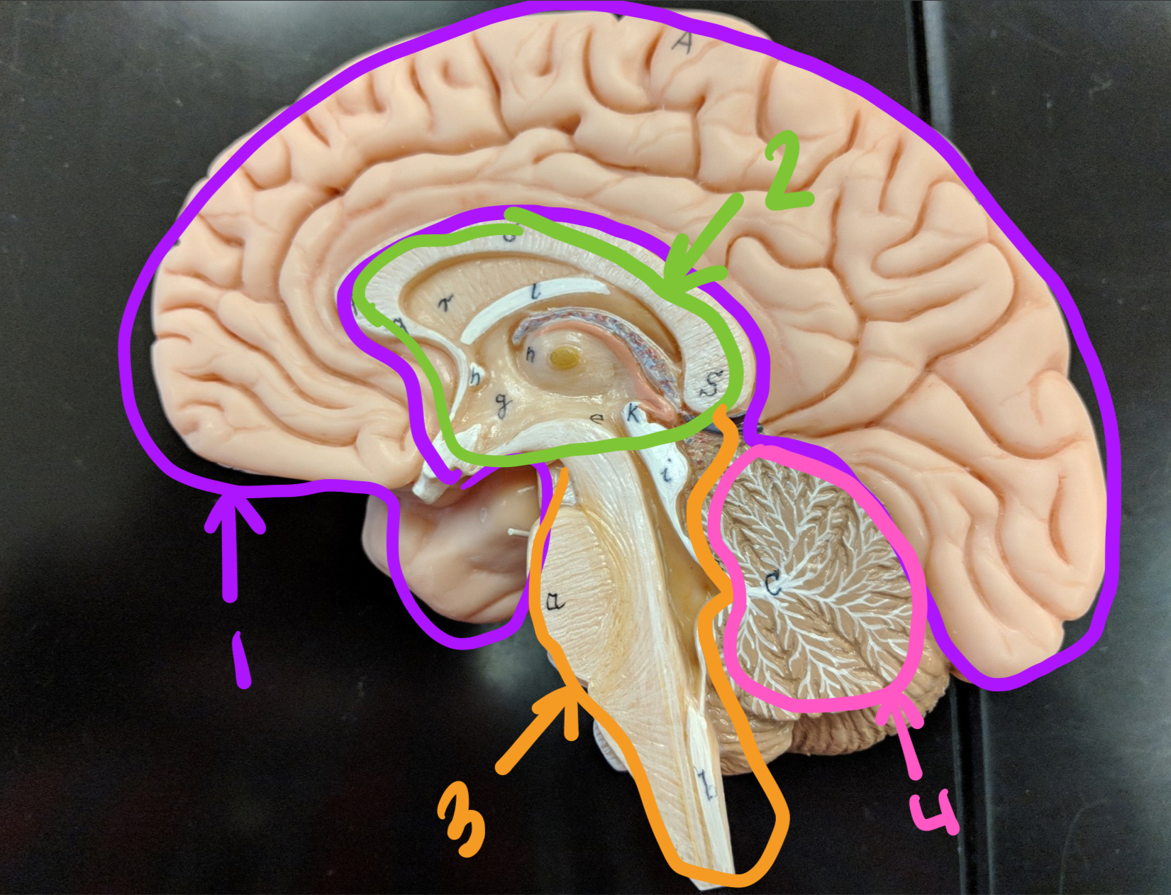 <p><strong>major regions of the brain + the spine</strong></p><p style="text-align: start">what is this at 3?</p>