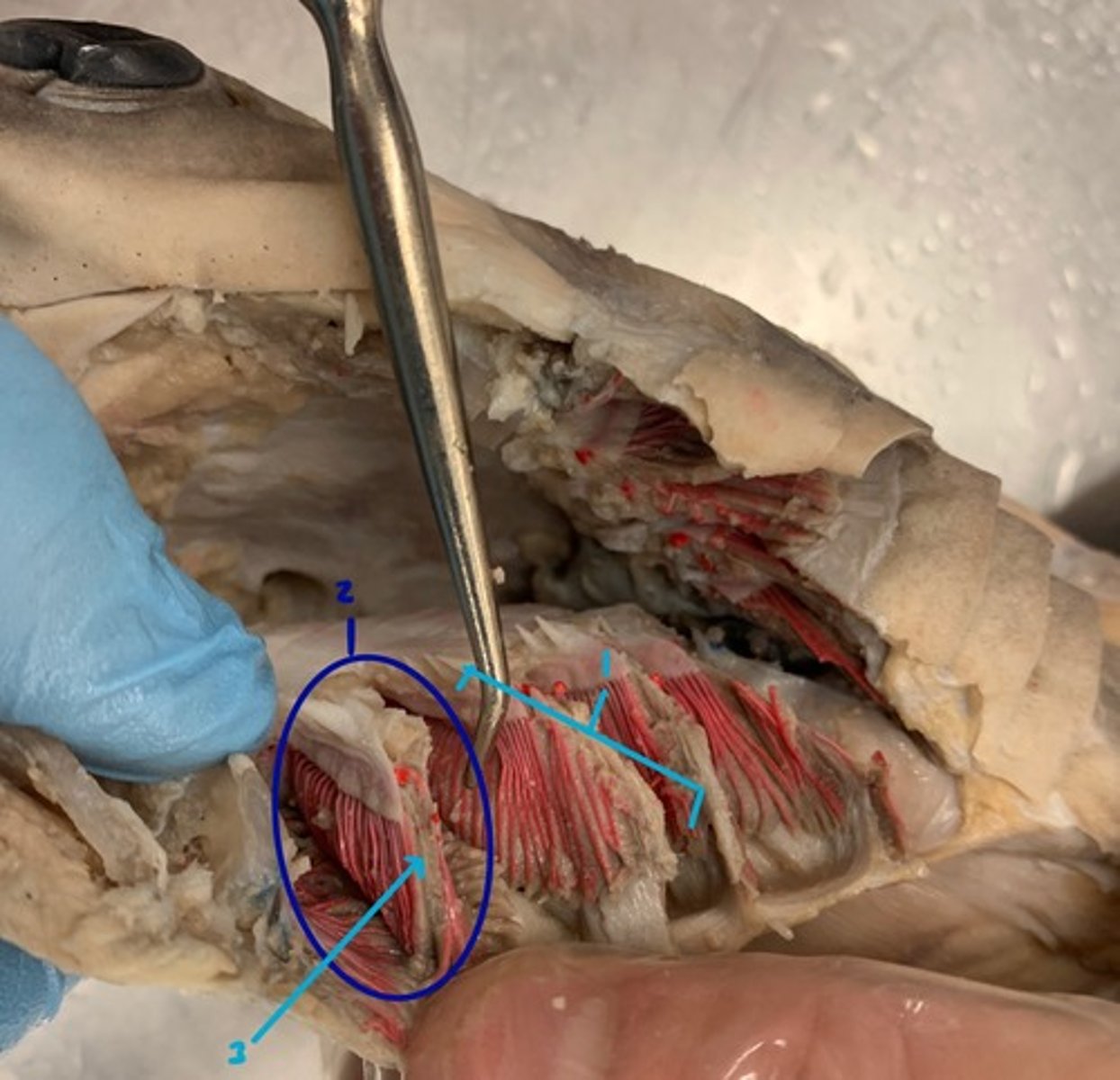 <p>Interbranchial Septum</p>