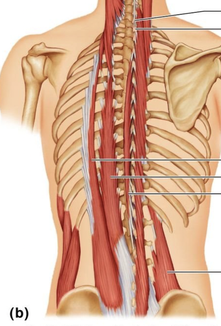 <p>lateral most muscle shown is</p>