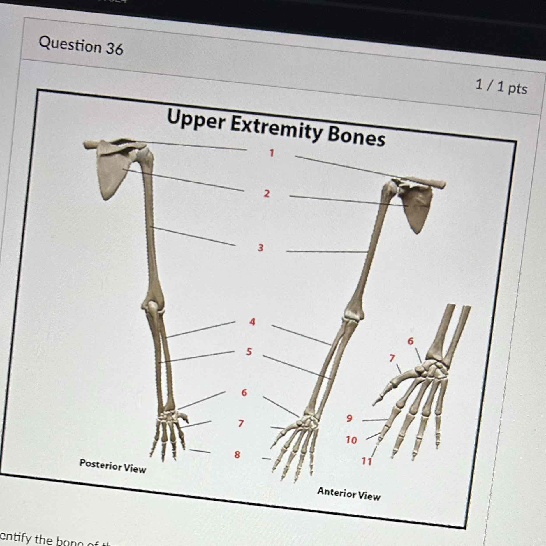 <p>Upper extremity labeled a #1</p>
