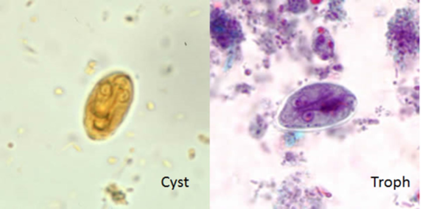 <p>Giardiasis</p><p>Protozoa - Excavata<br>fecal-oral route - cysts in feces contaminate water</p><p>have an excavate (depression on surface of cell)</p>