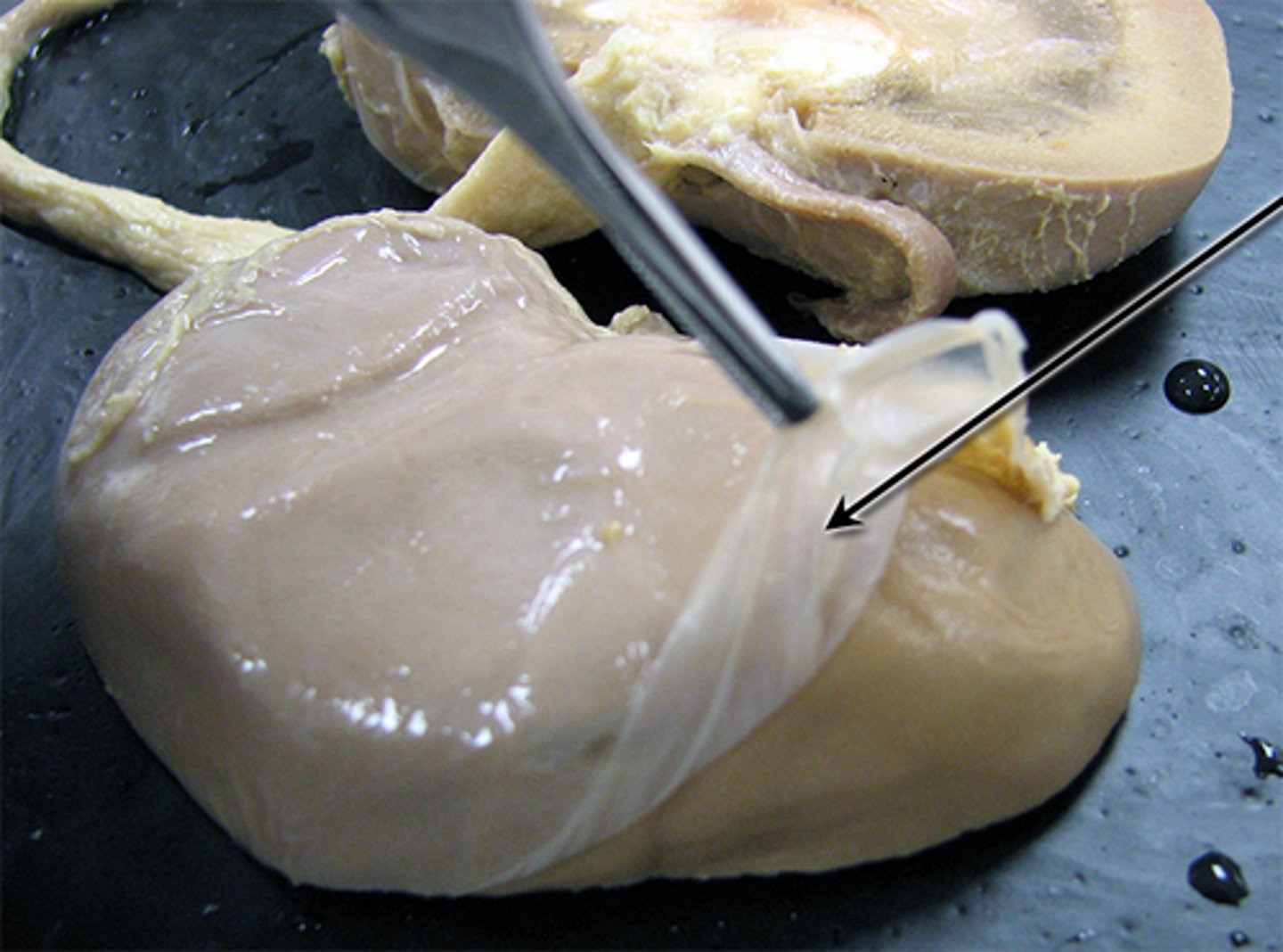 <p>Inner fibrous layer directly covering kidney</p>
